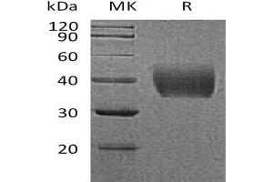 Western Blotting (WB) image for Coagulation Factor III (thromboplastin, Tissue Factor) (F3) protein (His tag) (ABIN7320770)