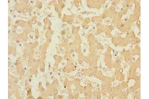 Immunohistochemistry of paraffin-embedded human liver tissue using ABIN7167108 at dilution of 1:100 (RAPGEF4 抗体  (AA 1-210))