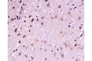 Immunohistochemistry (Paraffin-embedded Sections) (IHC (p)) image for anti-Neurotrophic Tyrosine Kinase, Receptor, Type 2 (NTRK2) (AA 32-120) antibody (ABIN727310)