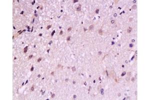 Formalin-fixed and paraffin embedded: rat brain tissue labeled with Anti-TrkB Polyclonal Antibody, Unconjugated  at 1:200, followed by conjugation to the secondary antibody and DAB staining (TRKB 抗体  (AA 32-120))