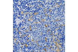 Immunohistochemistry of paraffin-embedded rat spleen using IQG antibody (ABIN7268020) at dilution of 1:200 (40x lens). (IQGAP1 抗体  (AA 500-750))