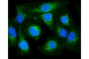 IF analysis of COX6B1 using anti-COX6B1 antibody (ABIN7603206).