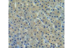 Used in DAB staining on fromalin fixed paraffin- embedded liver tissue (FAK 抗体  (AA 798-1041))