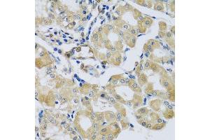 Immunohistochemistry of paraffin-embedded human stomach using SYT11 antibody. (SYT11 抗体  (AA 37-200))