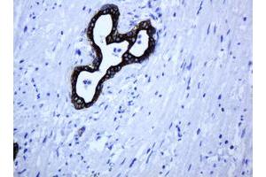 Image no. 3 for anti-ATP-Binding Cassette, Sub-Family B (MDR/TAP), Member 1 (ABCB1) (AA 995-1280) antibody (ABIN1491724)