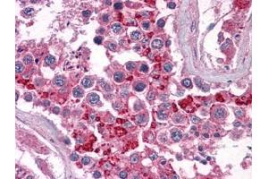 Human Testis: Formalin-Fixed, Paraffin-Embedded (FFPE) (BIRC3 抗体)