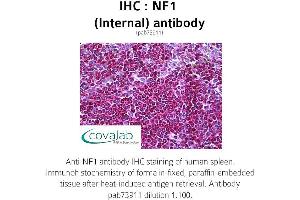 Image no. 2 for anti-Neurofibromin 1 (NF1) (Internal Region) antibody (ABIN1737327) (Neurofibromin 1 抗体  (Internal Region))