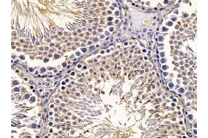 ABIN6259065 and ABIN6273580 at 1/100 staining rat testis tissue by IHC-P.