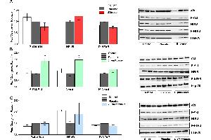 Western blot analysis of P-Akt/Akt ratio, NF-kB and P-NF-kB proteins of rats fed either placebo, (A) B. (NF-kB p65 抗体  (AA 51-100))