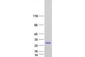 Western Blotting (WB) image for Nudix (Nucleoside Diphosphate Linked Moiety X)-Type Motif 7 (NUDT7) (Transcript Variant 1) protein (Myc-DYKDDDDK Tag) (ABIN2727719)