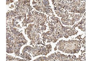 IHC analysis of TAB2 using anti-TAB2 antibody (ABIN7600244). (TAB2 抗体  (AA 169-522))
