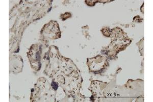 Immunoperoxidase of monoclonal antibody to ZIC4 on formalin-fixed paraffin-embedded human placenta. (ZIC4 抗体  (AA 249-319))