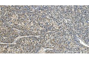 IHC analysis of Carbonic Anhydrase I/CA1 using anti-Carbonic Anhydrase I/CA1 antibody (ABIN7602620). (CA1 抗体  (AA 9-261))