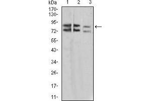 Western blot analysis using IL1RAPL1 mouse mAb against A431 (1), SK-Hep-1 (2), and HL-7702 (3) cell lysate.
