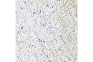 Immunohistochemistry of paraffin-embedded mouse heart using RCN2 antibody at dilution of 1:100 (x40 lens). (RCN2 抗体)