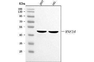 Western blot analysis of RNF34 using anti-RNF34 antibody (ABIN7601799).