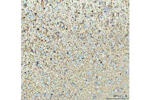 IHC analysis of TNR using anti-TNR antibody (ABIN4886752). (Tenascin R 抗体  (C-Term))