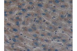 Detection of SHH in Human Liver Tissue using Polyclonal Antibody to Hedgehog Homolog, Sonic (SHH) (Sonic Hedgehog 抗体  (AA 36-193))