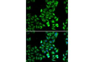 Immunofluorescence analysis of HeLa cell using DRD5 antibody. (DRD5 抗体)