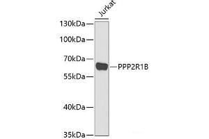 Western blot analysis of extracts of Jurkat cells using PPP2R1B Polyclonal Antibody at dilution of 1:1000. (PPP2R1B 抗体)