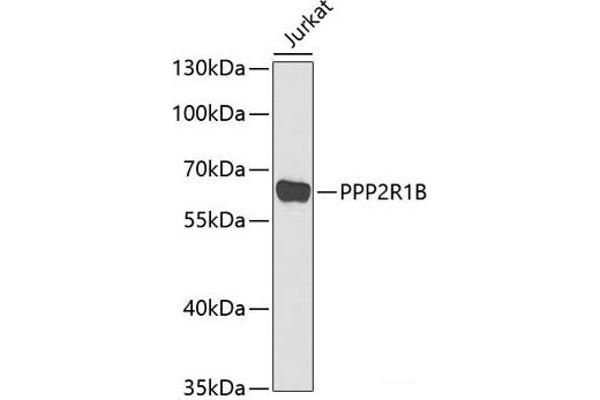 PPP2R1B 抗体