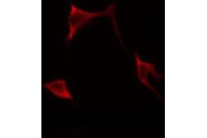 ABIN6268699 staining HeLa by IF/ICC. (BMP3 抗体  (Internal Region))
