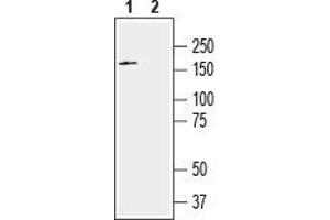 SLITRK2 抗体  (Extracellular, N-Term)