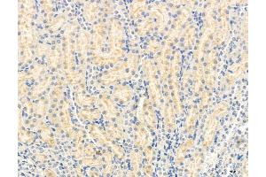 anti-Oxysterol Binding Protein (OSBP) (Internal Region) antibody