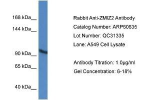 Western Blotting (WB) image for anti-Zinc Finger, MIZ-Type Containing 2 (ZMIZ2) (Middle Region) antibody (ABIN2788517)