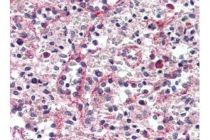 Human Spleen, Red Pulp (formalin-fixed, paraffin-embedded) stained with CTNND1at 1/15 followed by biotinylated goat anti-rabbit IgG secondary antibody, alkaline phosphatase-streptavidin and chromogen. (CTNND1 抗体  (C-Term))