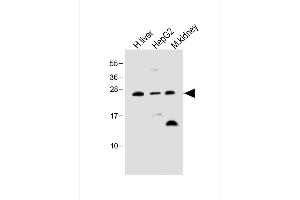 All lanes : Anti-Erythropoietin Antibody at 1:500 dilution Lane 1: Human liver lysate Lane 2: HepG2 whole cell lysate Lane 3: Mouse kidney lysate Lysates/proteins at 20 μg per lane. (EPO 抗体)