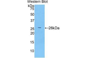 Western blot analysis of the recombinant protein. (TLR5 抗体  (AA 693-858))
