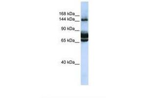 Image no. 1 for anti-Family with Sequence Similarity 83, Member B (FAM83B) (AA 828-877) antibody (ABIN6739431) (FAM83B 抗体  (AA 828-877))