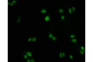 Immunofluorescence staining of PC3 cells with ABIN7127500 at 1:60, counter-stained with DAPI. (Recombinant FOXO3 抗体)