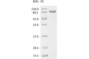 Glutamate-Ammonia Ligase (GLUL) (AA 2-554), (full length) protein (His tag)