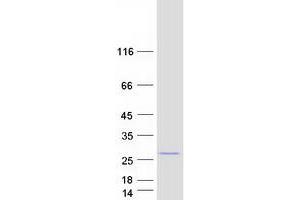 Western Blotting (WB) image for PEST Proteolytic Signal Containing Nuclear Protein (PCNP) protein (Myc-DYKDDDDK Tag) (ABIN2728443)