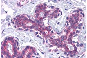 Human Breast: Formalin-Fixed, Paraffin-Embedded (FFPE) (SCAMP4 抗体  (C-Term))