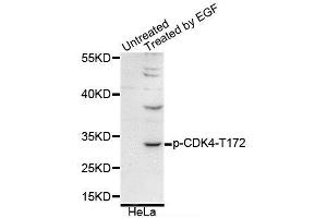Western blot analysis of extracts of various cell lines, using Phospho-CDK4-T172 antibody (ABIN5995651). (CDK4 抗体  (pThr172))