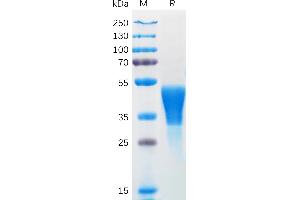 SDS-PAGE (SDS) image for Colony Stimulating Factor 1 (Macrophage) (CSF1) (AA 33-255) protein (His tag) (ABIN7092731)