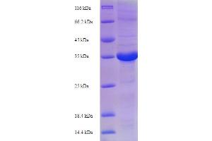 SDS-PAGE (SDS) image for Erythropoietin (EPO) (AA 27-192) protein (His-SUMO Tag) (ABIN5709479)