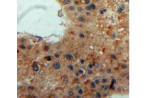 IHC-P analysis of Liver tissue, with DAB staining. (Lipase A 抗体  (AA 32-358))