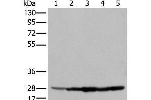 Western blot analysis of 293T cell Hela cell A549 cell using ECI1 Polyclonal Antibody at dilution of 1:350 (DCI 抗体)