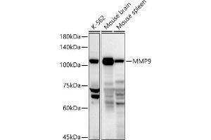 Western blot analysis of extracts of various cell lines, using MMP9 antibody (ABIN3022899, ABIN3022900, ABIN3022901, ABIN1513215 and ABIN6219286) at 1:1000 dilution. (MMP 9 抗体  (AA 538-707))
