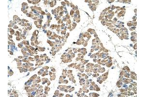 SLC22A7 antibody was used for immunohistochemistry at a concentration of 4-8 ug/ml to stain Skeletal muscle cells (arrows) in Human Muscle. (SLC22A7 抗体)