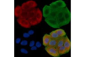ABIN6262407 and ABIN6276441 staining Hela cells(30 min of UV treatment) by IF/ICC. (GRP94 抗体  (C-Term))