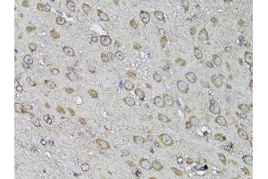 Immunohistochemistry of paraffin-embedded mouse brain using SNAI1 antibody (ABIN5998900) at dilution of 1/100 (40x lens). (SNAIL 抗体)