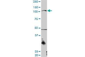 CTNNA3 MaxPab rabbit polyclonal antibody. (CTNNA3 抗体  (AA 1-516))