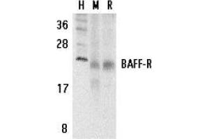 Western Blotting (WB) image for anti-Tumor Necrosis Factor Receptor Superfamily, Member 13C (TNFRSF13C) (C-Term) antibody (ABIN499403)