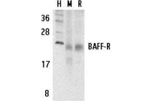 Western blot analysis of BAFF Receptor in human (H), mouse (M), and rat (R) spleen tissue lysates with AP30116PU-N BAFF Receptor antibody at 5 μg/ml.