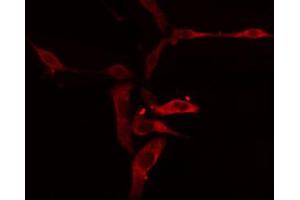 ABIN6274856 staining A549 cells by IF/ICC. (APOL1 抗体  (C-Term))